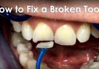 How to Repair a Cracked Tooth at Home: A Comprehensive Guide